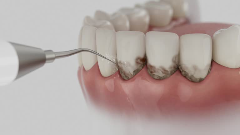 Reliable Dental Implants contractor in Hesperia, CA by Smile Center Dentistry